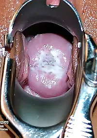 sara gyno vulva