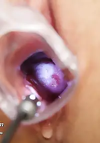 Gynecologist Porn Pics